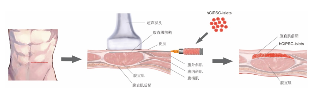 b3618965d4344f7a80aca40cbee51187.png b3618965d4344f7a80aca40cbee51187.png